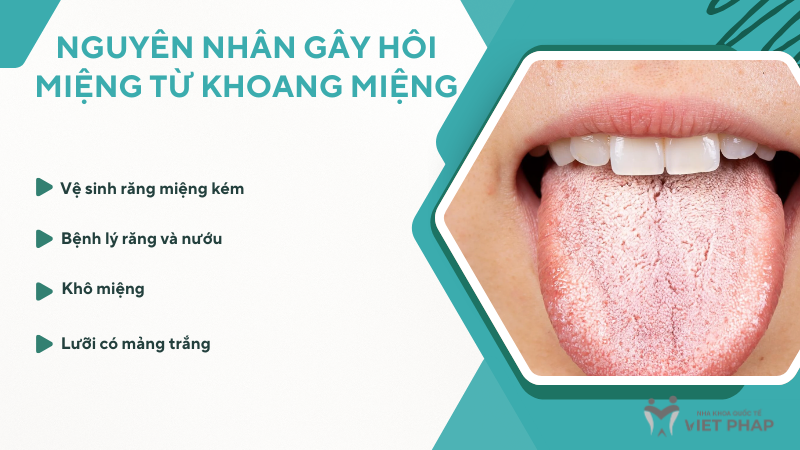 Nguyên nhân gây hôi miệng từ khoang miệng