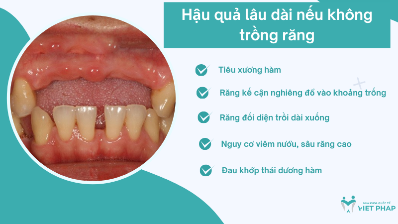 khong trong rang co sao khong 4 Hậu quả lâu dài nếu không trồng răng