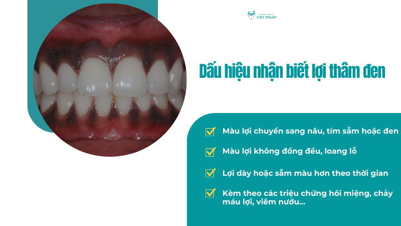 Dấu hiệu nhận biết lợi thâm đen