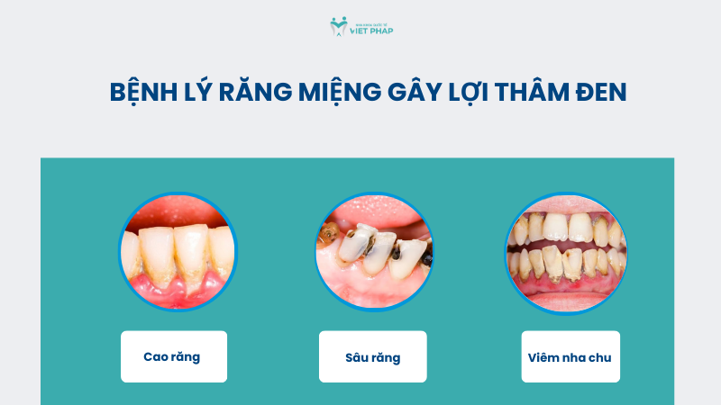 Bệnh lý răng miệng gây lợi thâm đen 