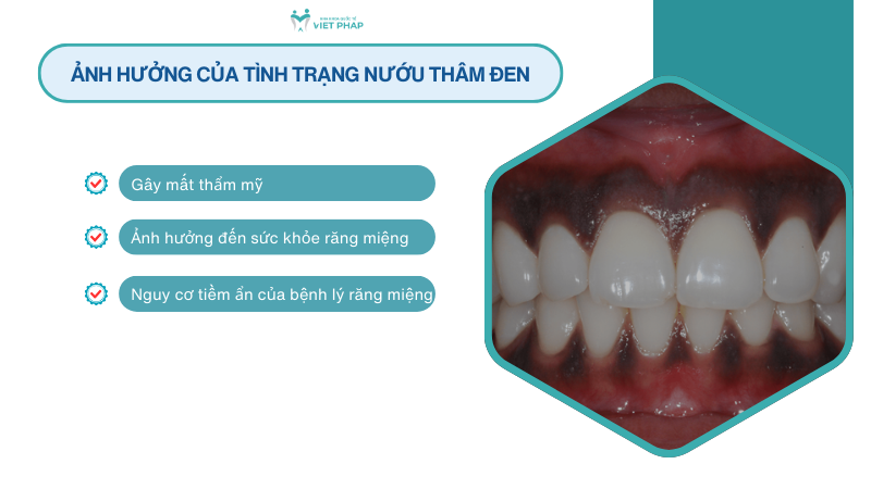 Ảnh hưởng của tình trạng nướu thâm đen