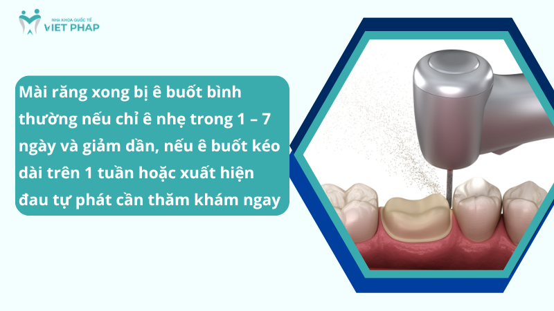 Mài răng xong bị ê buốt bình thường nếu chỉ ê nhẹ trong 1 – 7 ngày và giảm dần, nếu ê buốt kéo dài trên 1 tuần hoặc xuất hiện đau tự phát cần thăm khám ngay