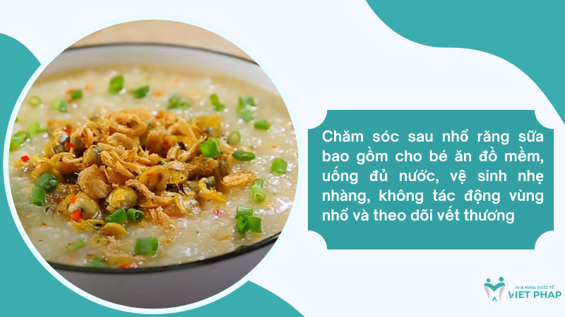 nho rang cho be 4 Chăm sóc sau nhổ răng sữa bao gồm cho bé ăn đồ mềm, uống đủ nước, vệ sinh nhẹ nhàng, không tác động vùng nhổ và theo dõi vết thương