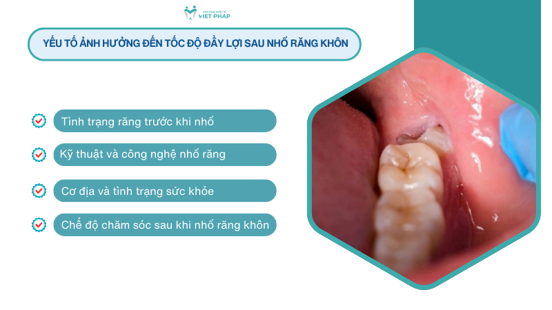 Yếu tố ảnh hưởng đến tốc độ đầy lợi sau nhổ răng khôn