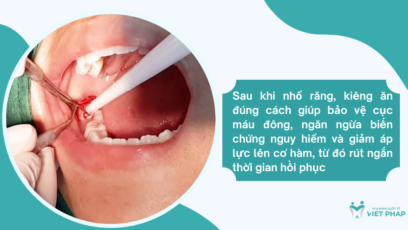 nho rang kieng an gi Sau khi nhổ răng, kiêng ăn đúng cách giúp bảo vệ cục máu đông, ngăn ngừa biến chứng nguy hiểm và giảm áp lực lên cơ hàm, từ đó rút ngắn thời gian hồi phục