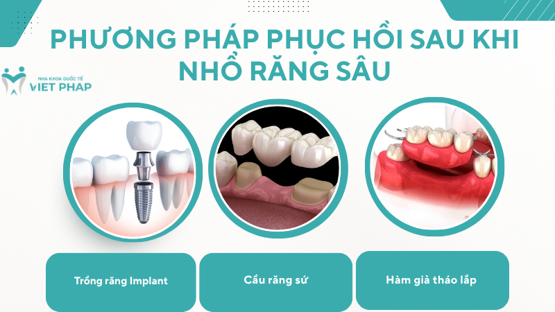 Phương pháp phục hồi sau khi nhổ răng sâu