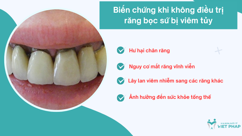 Biến chứng khi không điều trị răng bọc sứ bị viêm tủy