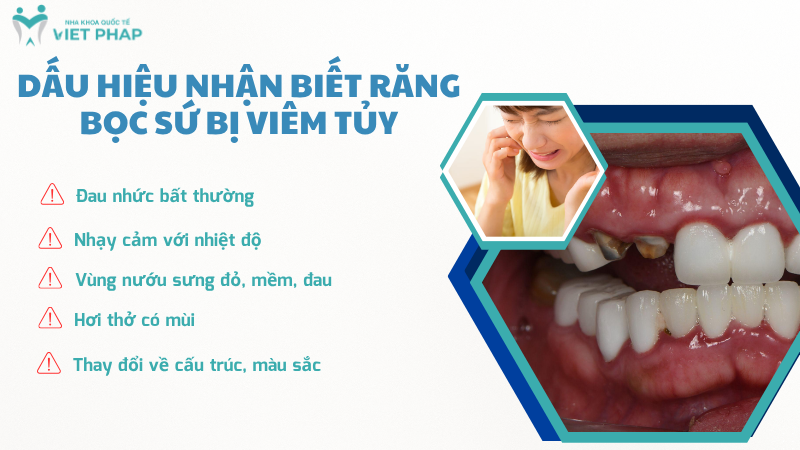 Dấu hiệu nhận biết răng bọc sứ bị viêm tủy