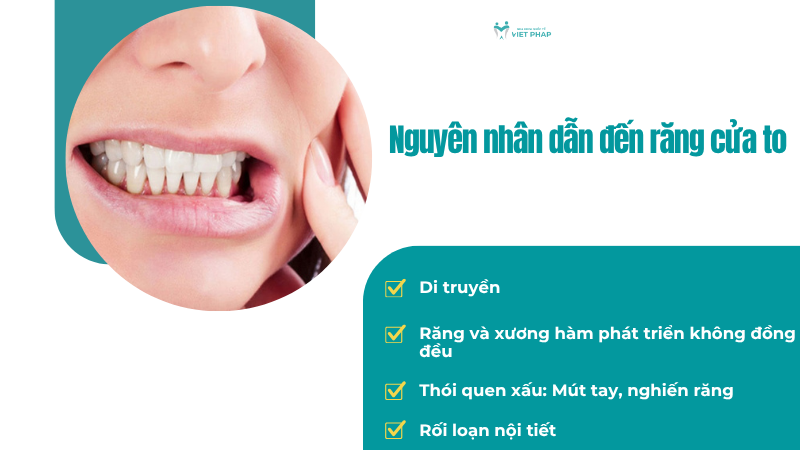 Nguyên nhân dẫn đến răng cửa to