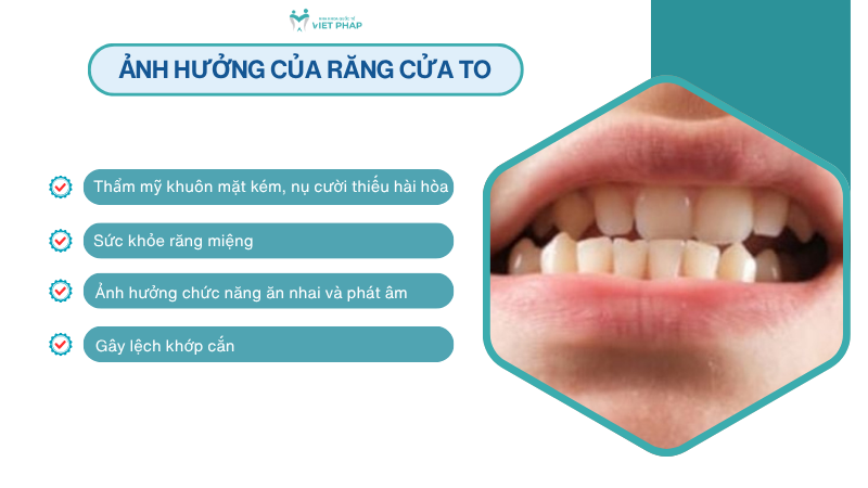 Ảnh hưởng của răng cửa to