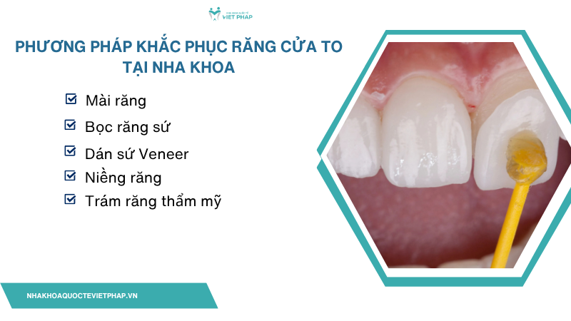 Phương pháp khắc phục răng cửa to tại nha khoa