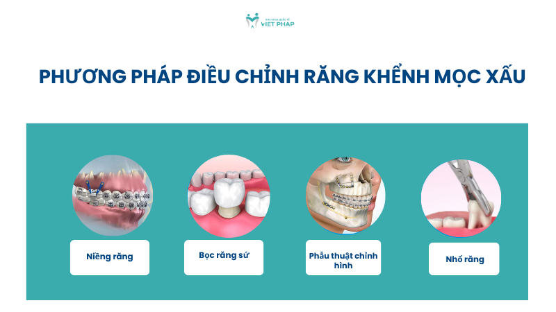 rang khenh 5 Phương pháp điều chỉnh răng khểnh mọc xấu