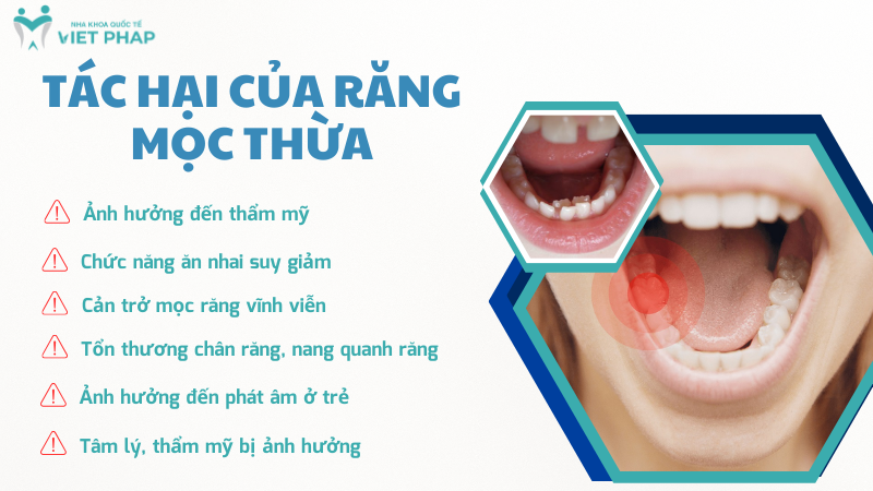 rang moc thua 5 Tác hại của răng mọc thừa