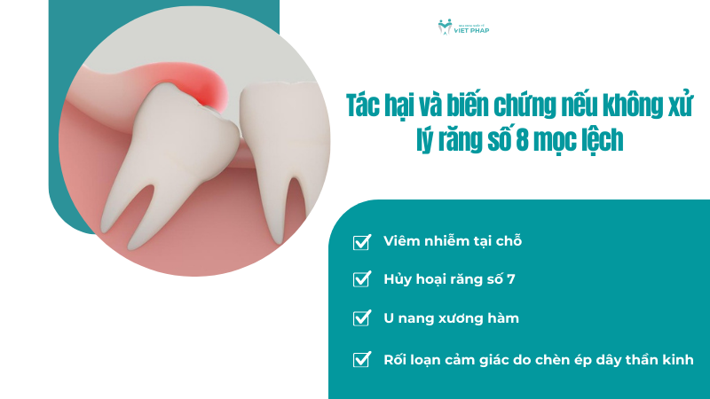 Tác hại và biến chứng nếu không xử lý răng số 8 mọc lệch