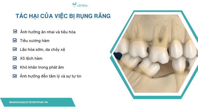Tác hại của việc bị rụng răng 