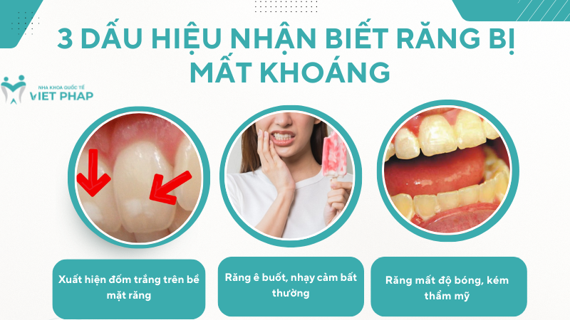 tai khoang rang 5 3 dấu hiệu nhận biết răng bị mất khoáng