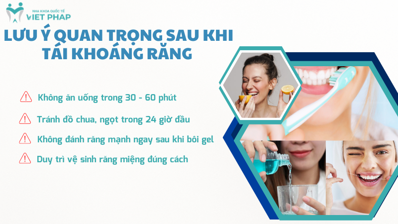 tai khoang rang 9 Lưu ý quan trọng sau khi tái khoáng răng