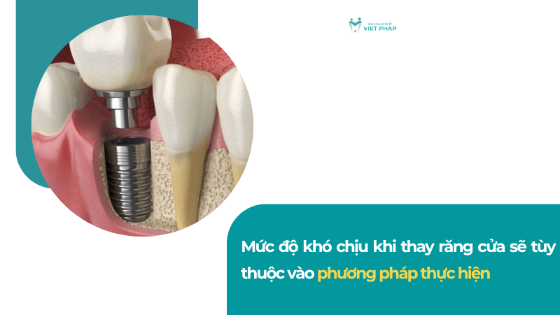 thay rang cua 6 Mức độ khó chịu khi thay răng cửa sẽ tùy thuộc vào phương pháp thực hiện