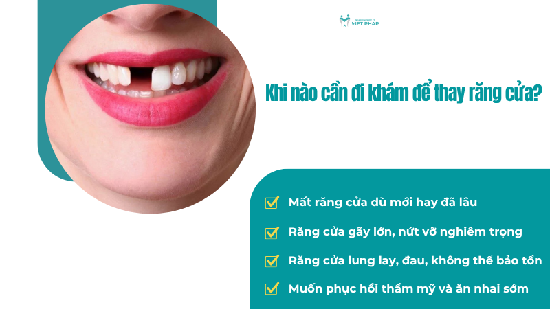 thay rang cua 9 Khi nào cần đi khám để thay răng cửa?