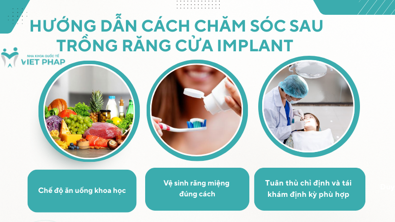 Hướng dẫn cách chăm sóc sau trồng răng cửa Implant 