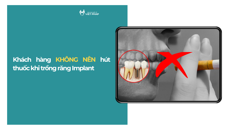 trong rang implant co hut thuoc duoc khong 1 Khách hàng KHÔNG NÊN hút thuốc khi trồng răng Implant