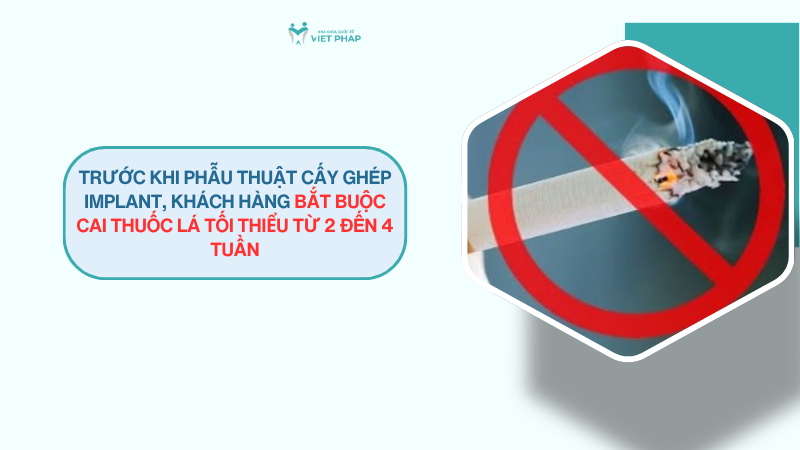 trong rang implant co hut thuoc duoc khong 3 Trước khi phẫu thuật cấy ghép implant, khách hàng bắt buộc cai thuốc lá tối thiểu từ 2 đến 4 tuần