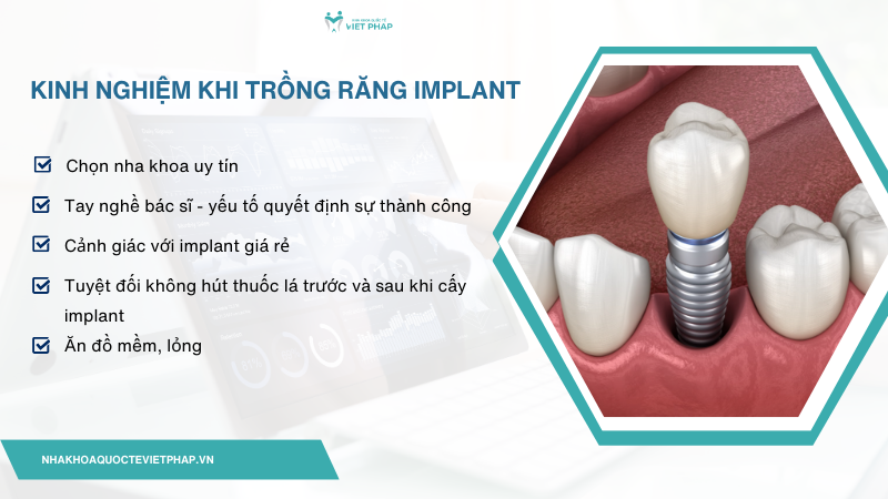 Kinh nghiệm khi trồng răng implant