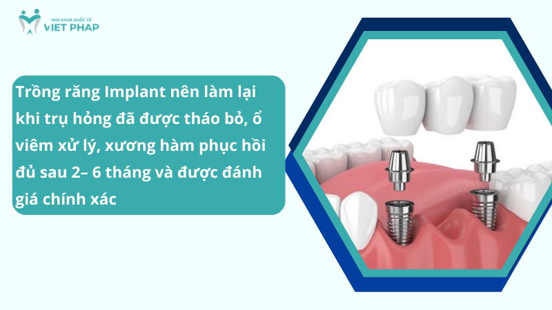 Trồng răng Implant nên làm lại khi trụ hỏng đã được tháo bỏ, ổ viêm xử lý, xương hàm phục hồi đủ sau 2– 6 tháng và được đánh giá chính xác 