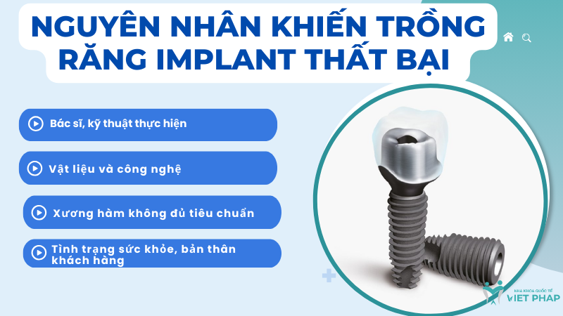 Nguyên nhân khiến trồng răng Implant thất bại