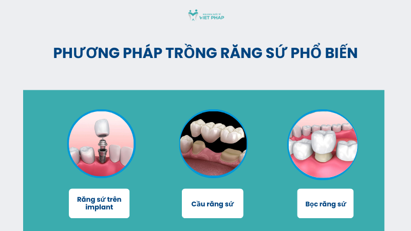 Phương pháp trồng răng sứ phổ biến