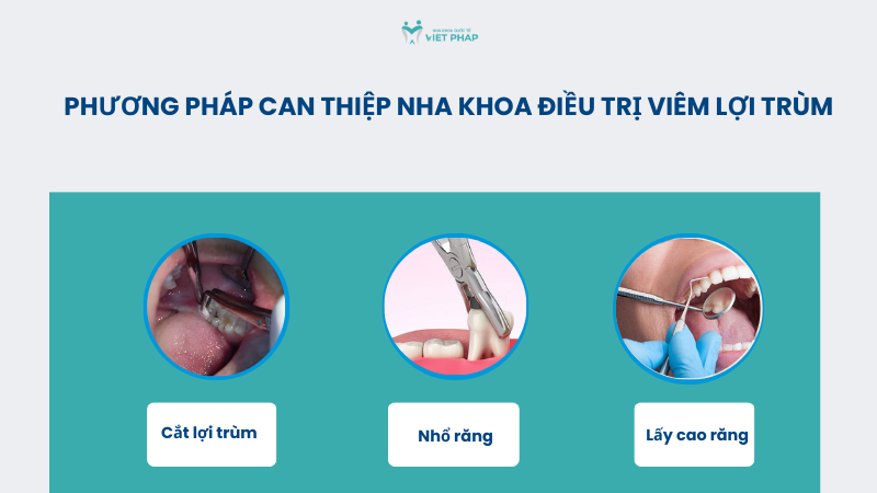 Phương pháp can thiệp nha khoa điều trị viêm lợi trùm