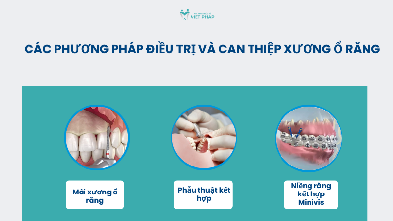 Các phương pháp điều trị và can thiệp xương ổ răng