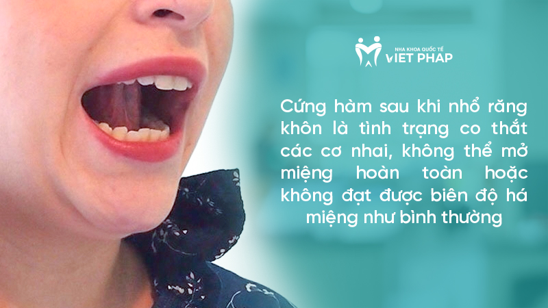 Cứng hàm sau khi nhổ răng khôn là tình trạng co thắt các cơ nhai, không thể mở miệng hoàn toàn hoặc không đạt được biên độ há miệng như bình thường 