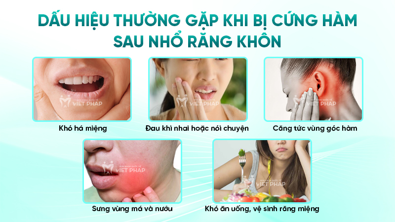 Dấu hiệu thường gặp khi bị cứng hàm sau nhổ răng khôn