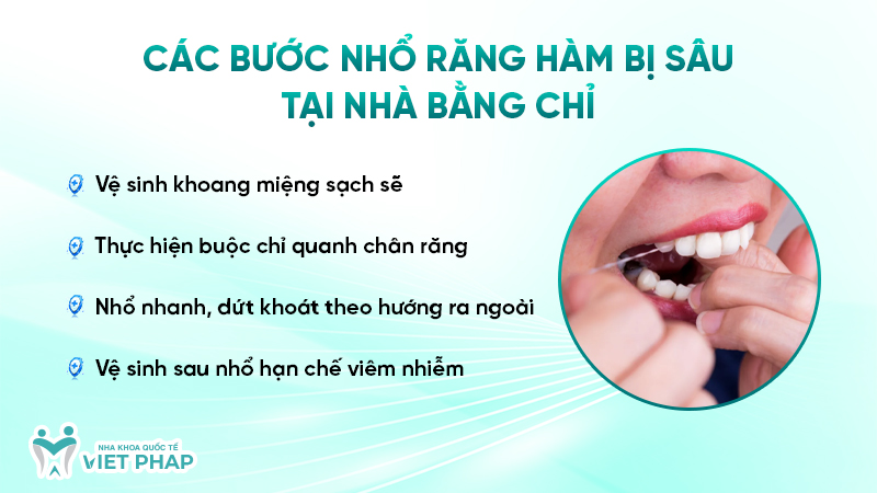Các bước nhổ răng hàm bị sâu tại nhà bằng chỉ