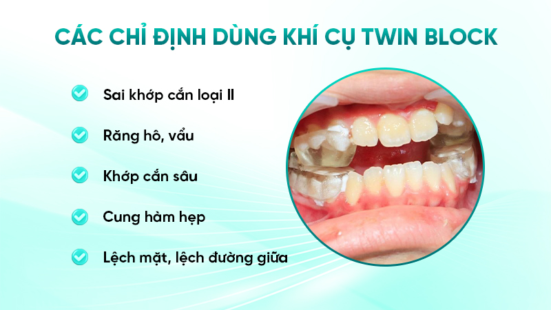 Các chỉ định dùng khí cụ Twin Block