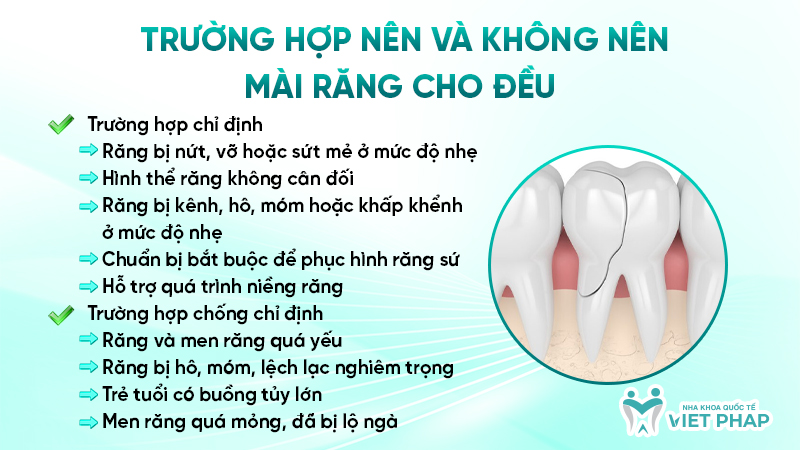 Trường hợp nên và không nên mài răng cho đều