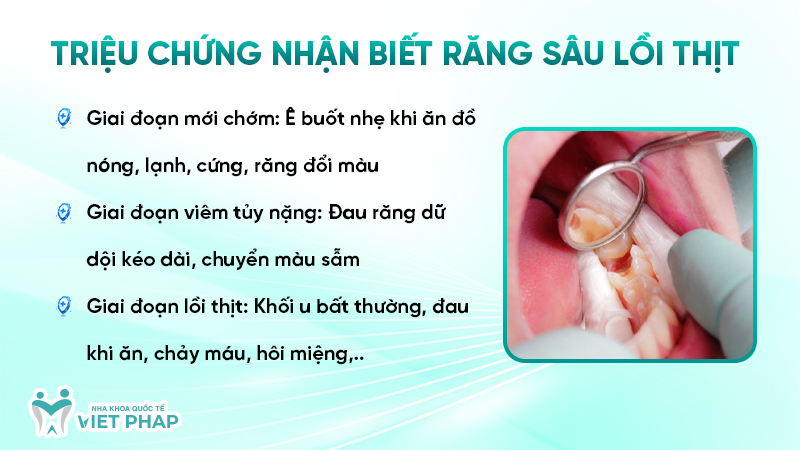 Triệu chứng nhận biết răng sâu lồi thịt