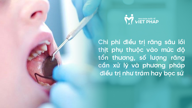 Chi phí điều trị răng sâu lồi thịt phụ thuộc vào mức độ tổn thương, số lượng răng cần xử lý và phương pháp điều trị như trám hay bọc sứ