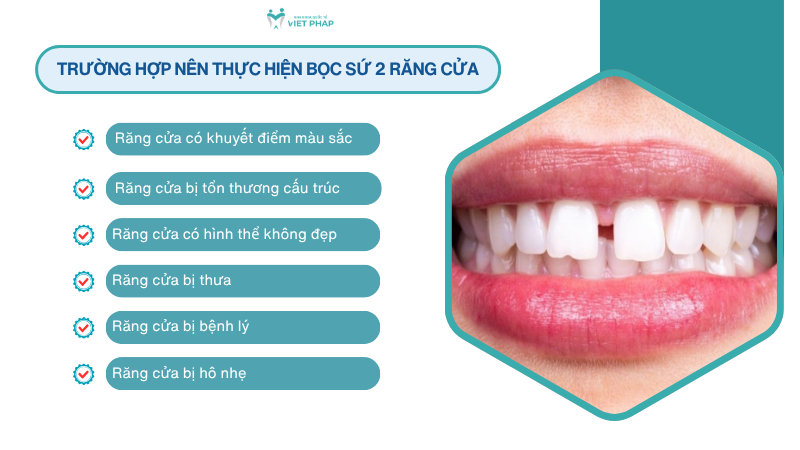 Trường hợp nên thực hiện bọc sứ 2 răng cửa 