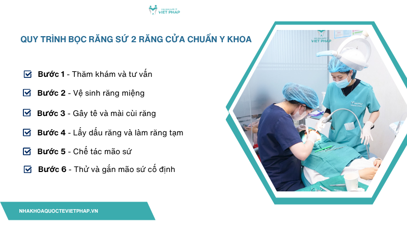Quy trình bọc răng sứ 2 răng cửa chuẩn y khoa