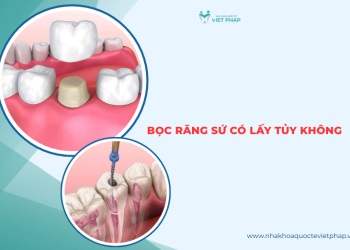 [Giải đáp] Bọc răng sứ có lấy tủy không? Trường BẮT BUỘC VÀ KHÔNG CẦN LẤY 