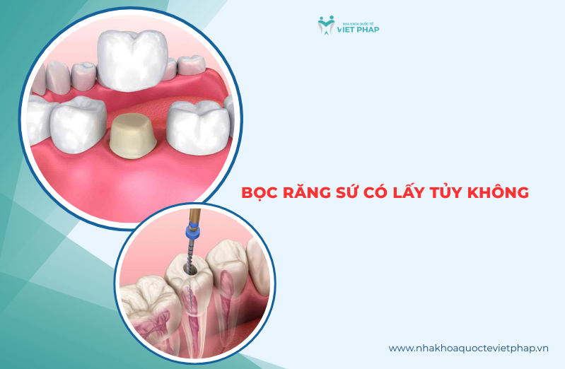 boc rang su co lay tuy khong thumb