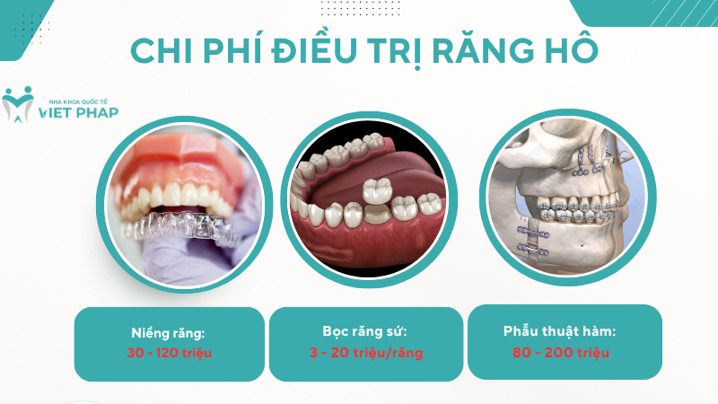 Chi phí điều trị răng hô