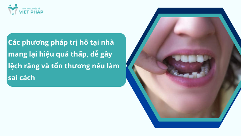 Các phương pháp trị hô tại nhà mang lại hiệu quả thấp, dễ gây lệch răng và tổn thương nếu làm sai cách