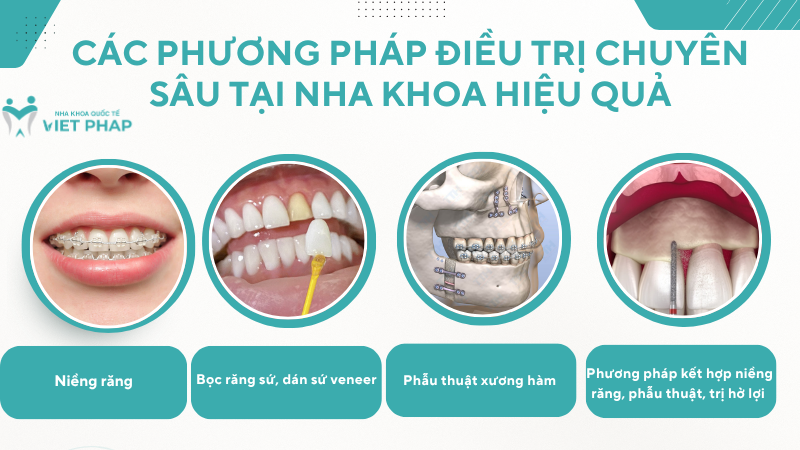 Các phương pháp điều trị chuyên sâu tại nha khoa hiệu quả