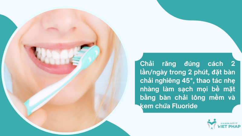 Chải răng đúng cách 2 lần/ngày trong 2 phút, đặt bàn chải nghiêng 45°, thao tác nhẹ nhàng làm sạch mọi bề mặt bằng bàn chải lông mềm và kem chứa Fluoride