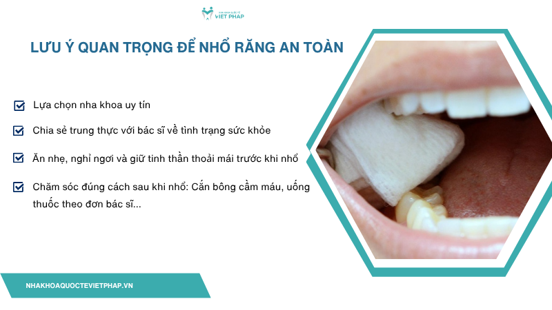 den thang co nho rang duoc khong 5 Lưu ý quan trọng để nhổ răng an toàn