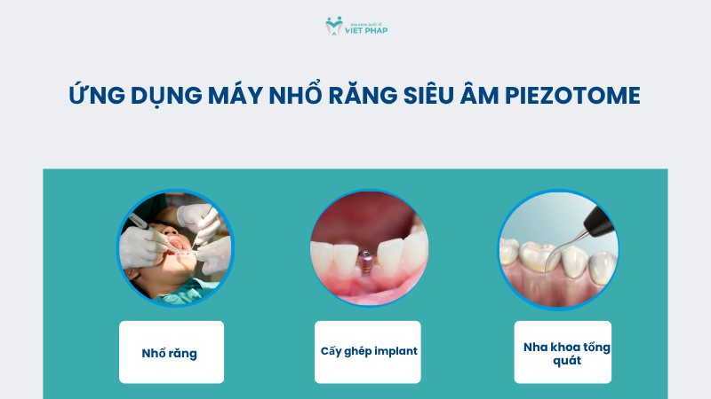 may nho rang sieu am piezotome 4 Ứng dụng máy nhổ răng siêu âm Piezotome