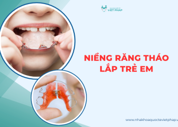 Niềng răng tháo lắp trẻ em